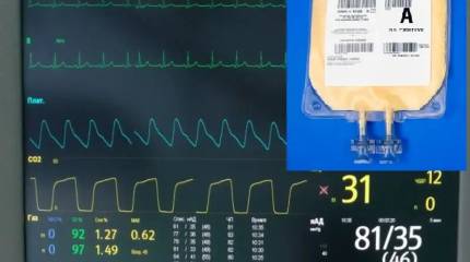 Сухая лиофилизированная плазма крови и СВО. Применение, технологии, ценообразование, логистика