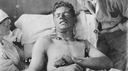 Из истории химического оружия