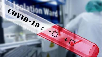 COVID-19: глобальному миру приходит конец