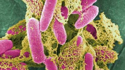 Probado: Infección mortal por E.coli creada en el laboratorio.