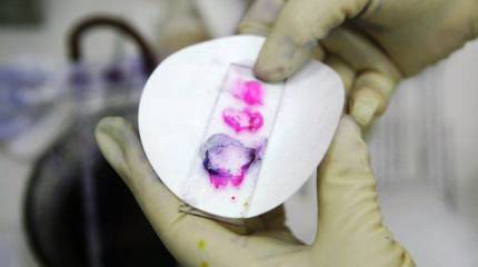 Bild: у американцев «произошли неполадки» при использовании спор сибирской язвы на учениях в Германии