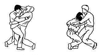 Основные поражающие точки руки и кисти