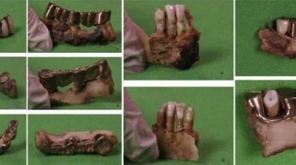 Французские учёные завершили изучение останков Гитлера в архиве ФСБ. Каковы выводы