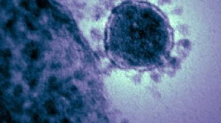 Коронавирус: made in USA?