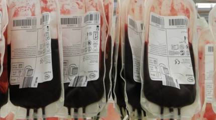 Военный госпиталь в Киеве начал массовый сбор крови, что может быть признаком подготовки к контрнаступлению