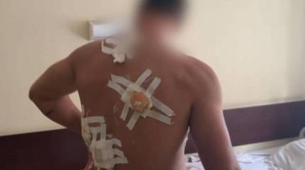 В Батайске задержан расстрелявший из травматического пистолета участника СВО