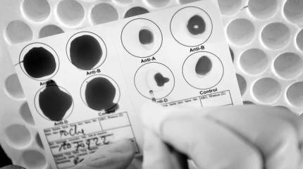 Конго: СПИД как оружие