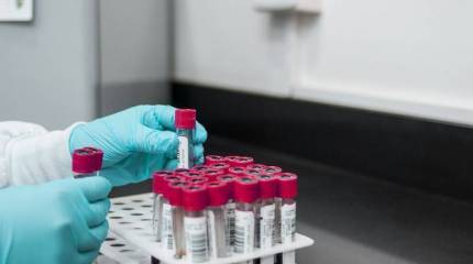 Китай призвал изучить военно-биологическую деятельность США на Украине