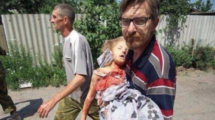 «Меня лечил донецкий врач», или Исповедь бойца ВСУ