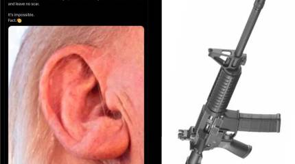 В соцсетях США обсуждают ухо Трампа без следов от выстрела из AR-15