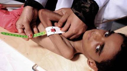 Проправительственные силы Йемена прекратили наступление на порт Ходейда. По гуманитарным соображениям?