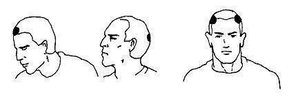 Поражающие точки человеческого тела: голова