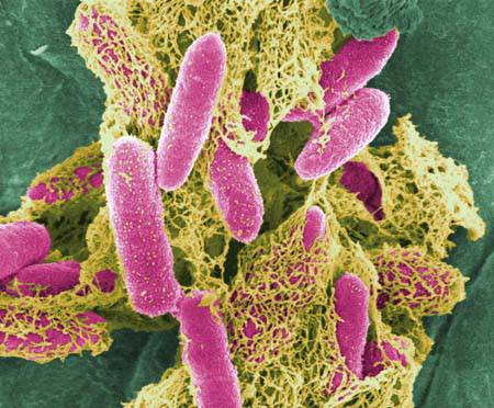 证明：在实验室中产生大肠杆菌致命的感染