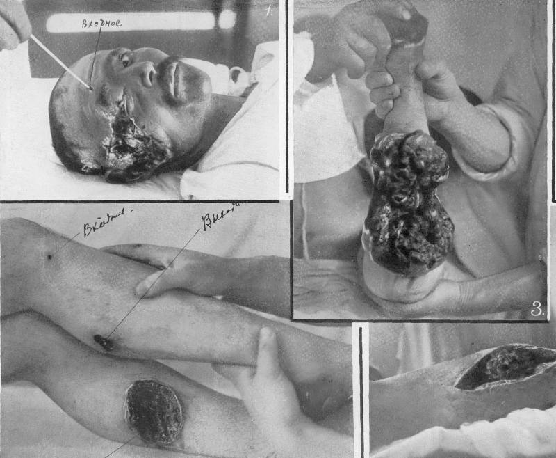 Разрывное варварство